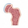 upload/articles/thumbs/031012111436Joint Osteoporosis icon.jpg